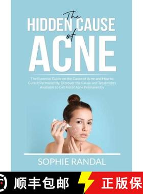 预订 Hidden Cause of Acne: The Essential Guide on the Cause of Acne and How to Cure it Permanently, D... [9786069837412]