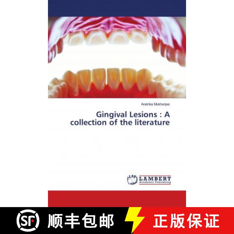 预订 Gingival Lesions : A collection of the literature [9786137435182]
