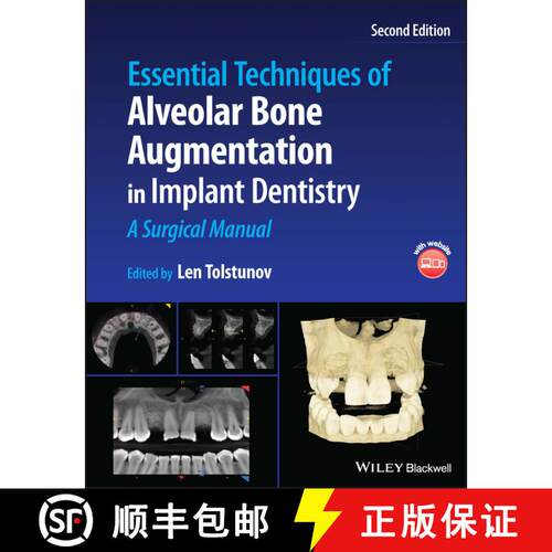 【3-4周达】精装 Essential Techniques of Alveolar Bone Augmentation in Implant Dentistry: A Surgical M... [9781119827320]