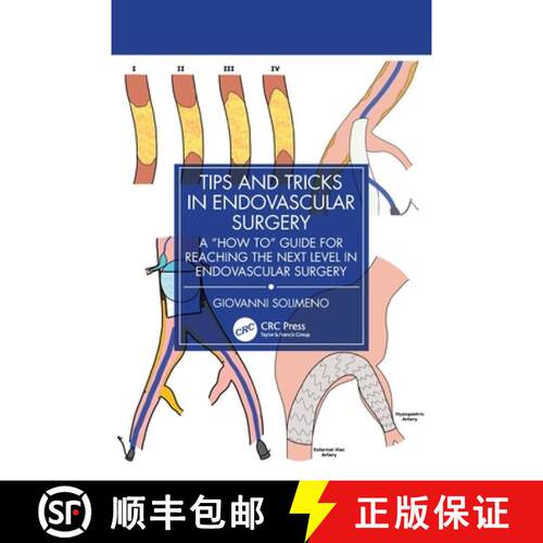 【3-4周达】Tips and Tricks in Endovascular Surgery: A How to Guide for reaching the next Level in End... [9781032936710]