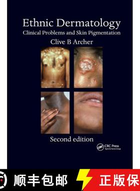 【3-4周达】Ethnic Dermatology: Clinical Problems and Skin Pigmentation [9780367386634]