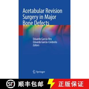 9783030075125 4周达 Defects Bone Major Surgery Revision Acetabular