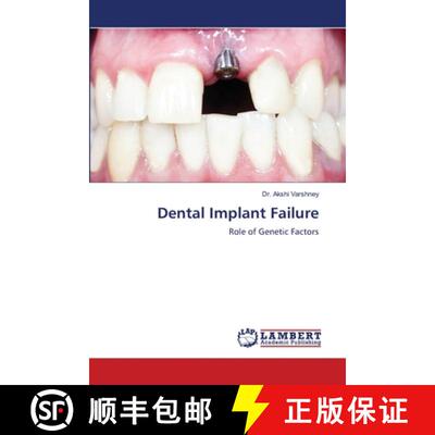 预订 Dental Implant Failure [9786207456345]