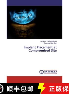 预订 Implant Placement at Compromised Site [9786200256393]