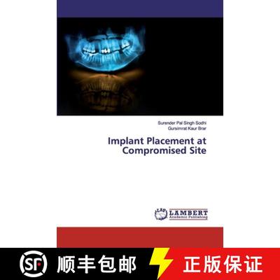 预订 Implant Placement at Compromised Site [9786200256393]