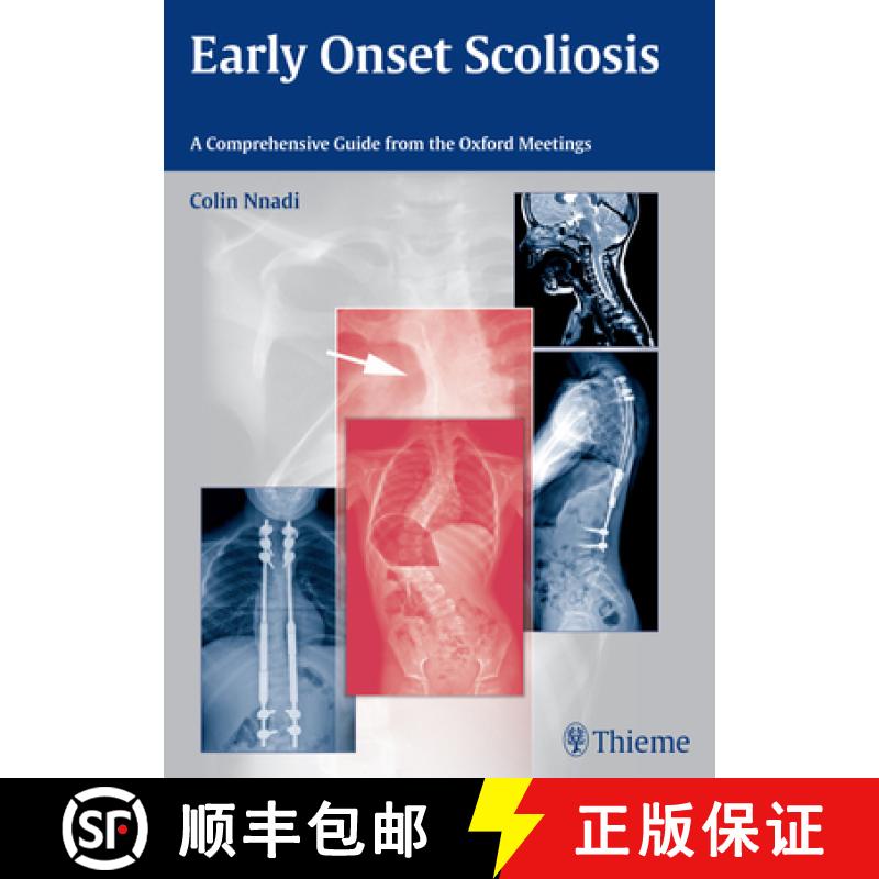 【3-4周达】Early Onset Scoliosis: A Comprehensive Guide from the Oxford Meetings [9783131726612]