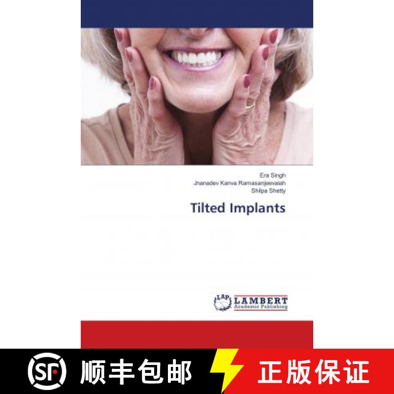预订 Tilted Implants [9786138329435]