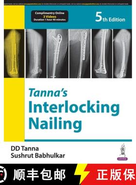 【3-4周达】Tanna's Interlocking Nailing [9789356964907]