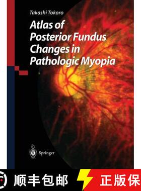 【3-4周达】Atlas of Posterior Fundus Changes in Pathologic Myopia [9784431680185]
