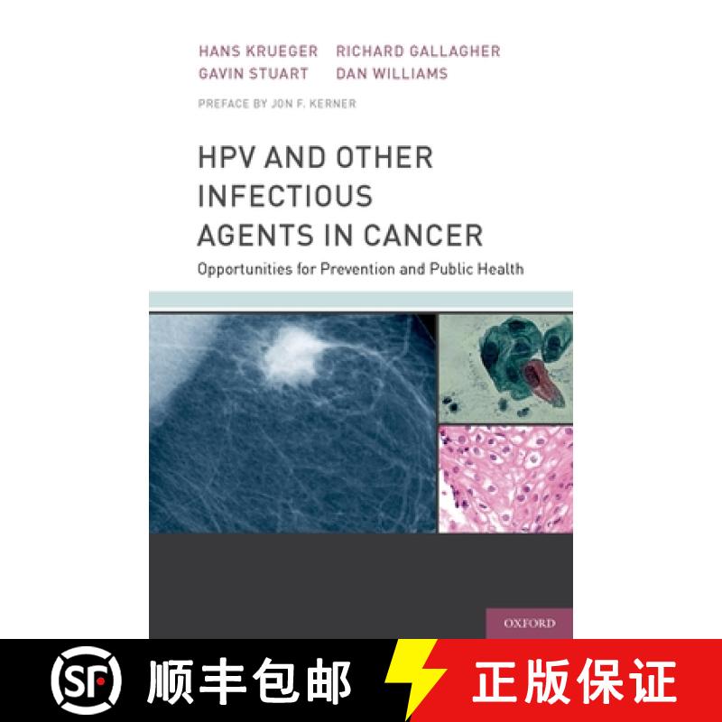【3-4周达】Hpv and Other Infectious Agents in Cancer: Opportunities for Prevention and Public Health [9780199732913]