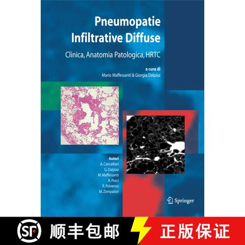 【3-4周达】Pneumopatie Infiltrative Diffuse : Clinica, Anatomia Patologica, HRTC [9788847002746]