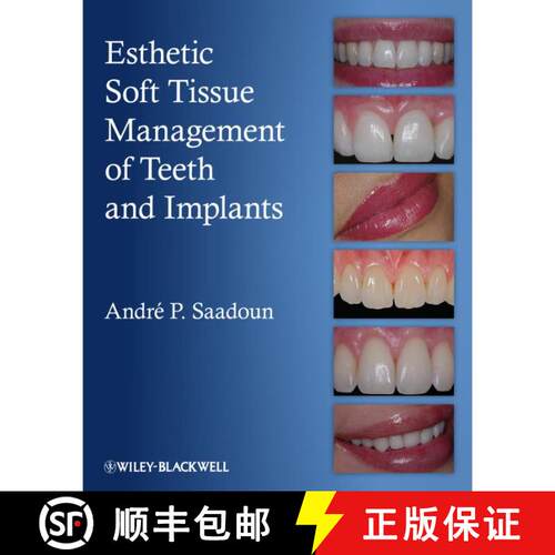 【3-4周达】精装 Esthetic Soft Tissue Management Of Teeth And Implants [Wiley牙科医学] [9781118301159]