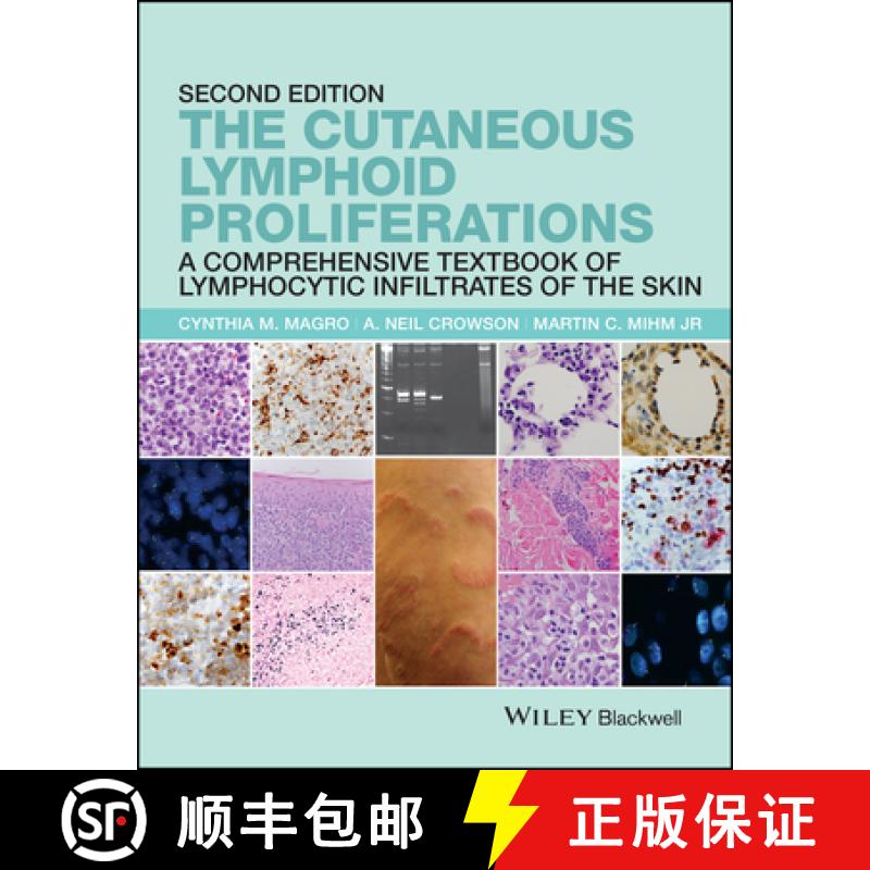 【3-4周达】The Cutaneous Lymphoid Proliferations:  A Comprehensive Textbook Of Lymphocytic Infiltrate... [9781118776261]