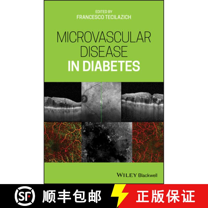 【3-4周达】Microvascular Disease In Diabetes [Wiley医学] [9781119309604]