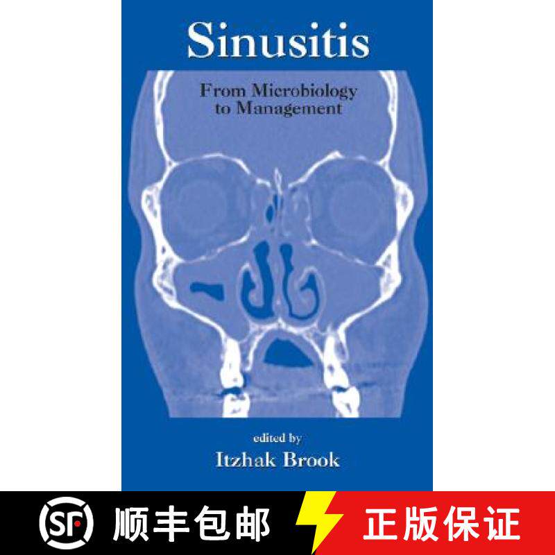 【3-4周达】Sinusitis : From Microbiology To Management [9780824729486]