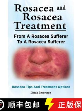 预订 Rosacea and Rosacea Treatment. From A Rosacea Sufferer To A Rosacea Sufferer. Rosacea Tips And T... [9781910941881]