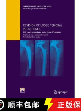 【3-4周达】Revision of loose femoral prostheses with a stem system based on the press-fit principle: ... [9782287396267]