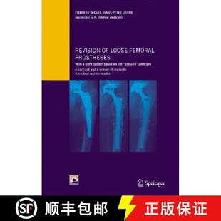 the system stem press ... fit principle 9782287396267 femoral 4周达 Revision prostheses based with loose