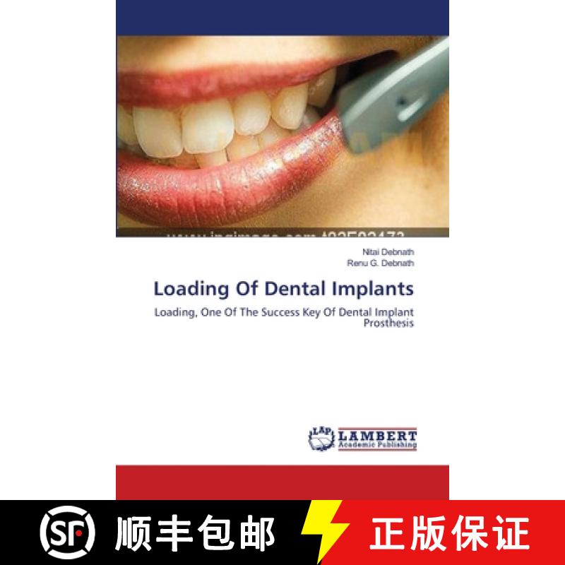 预订 Loading Of Dental Implants [9783659557620]