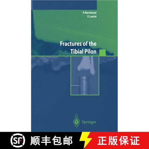【3-4周达】Fractures of the Tibial Pilon [9788847002487]