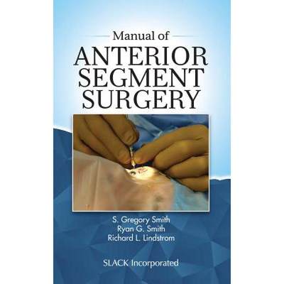 【4周达】Manual of Anterior Segment Surgery [9781630916206]