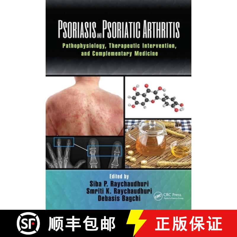 【4周达】Psoriasis and Psoriatic Arthritis: Pathophysiology, Therapeutic Intervention, and Complement... [9781032095868]