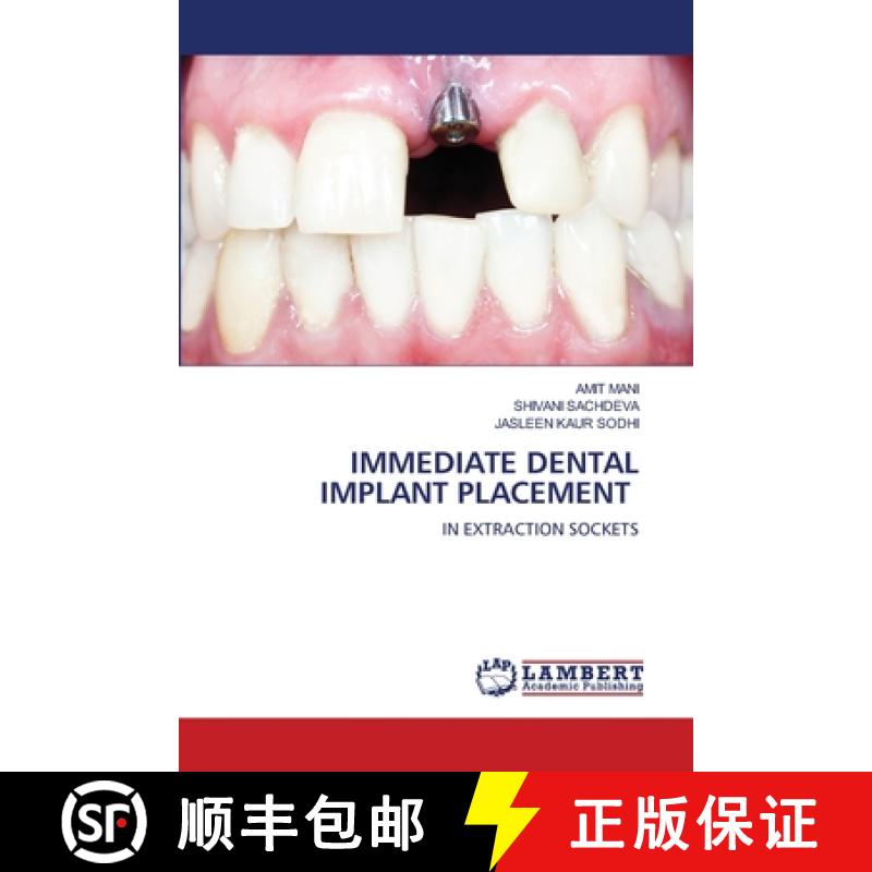 【3-4周达】Immediate Dental Implant Placement [9786203202847]