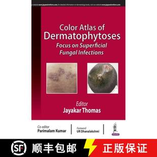 Focus Infections Color Fungal 4周达 9789389188387 Atlas Superficial Dermatophytoses