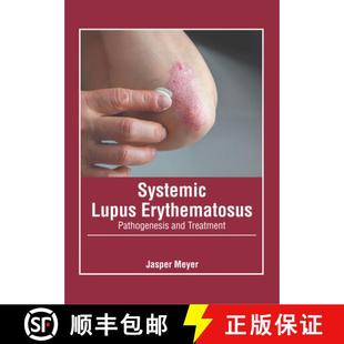Systemic Lupus Treatment 9781639272136 and 4周达 Pathogenesis Erythematosus