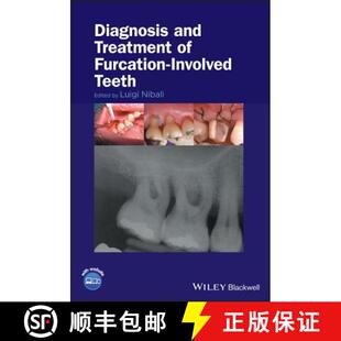 Teeth 9781119270652 Diagnosis Furcation Treatment 4周达 And Wiley牙科医学 Involved