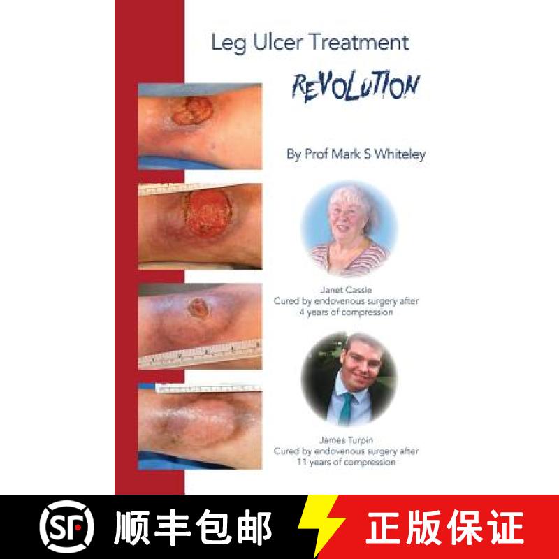 【2-3周达】Leg Ulcer Treatment Revolution [9781908586056]