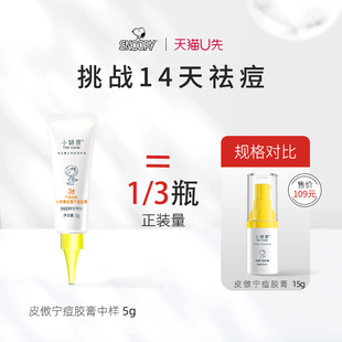 U先试用小妍青皮傲宁痘胶膏5g