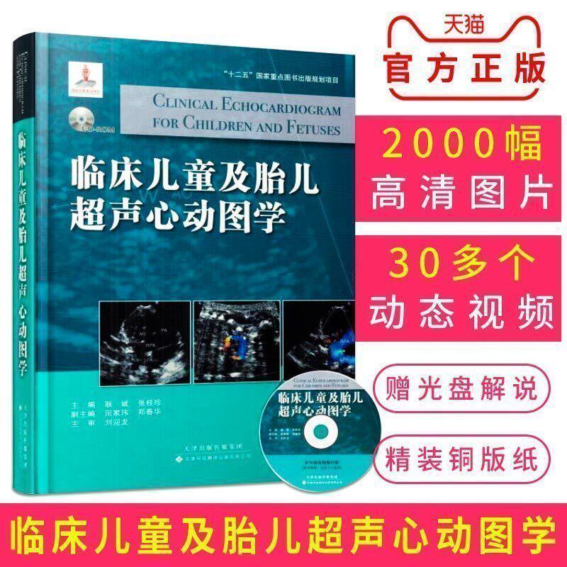 Genuine clinical children fetus Echocardiogram Attached disk) Editor Correlations GUI Zhen Zhang Congenital heart disease Echocardiogram diagnosis fetus Cardiovascular Deformity Screeningin the Books/Magazine/Newspaper , Medical Health , Medical Atlas  category - from Buy2taobao.com to provide professional Taobao agent buy service
