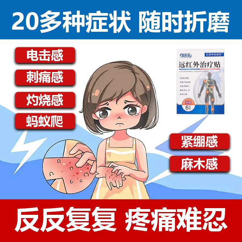 盈医森远红外治疗贴带状疹疱后遗症神经痛专用贴麻木刺痛感理疗贴