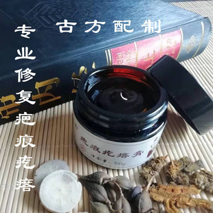 疤痕疙瘩膏修复红色凸起 增生性疤痕疙瘩刨腹产手术