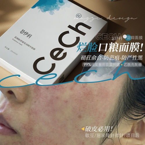 Cech瑟伊科蓝铜面膜胜肽退红舒缓