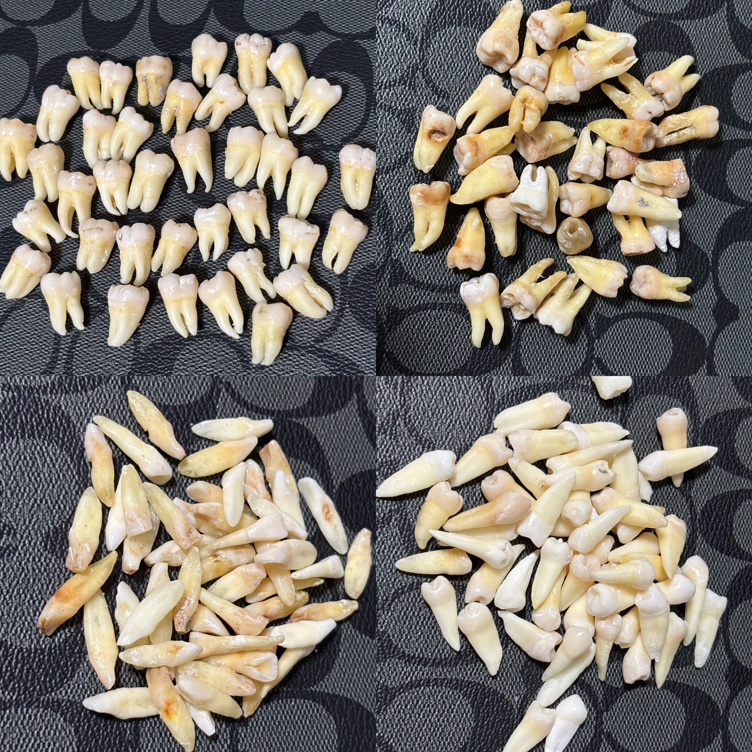 离体牙真人牙齿开髓备洞根管治疗考试专用完整无损无龋坏技能操作