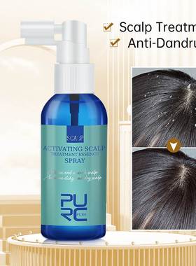 Hair Scalp Treatment Essence Spray Anti-Dandruff Smoothing S