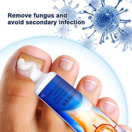 20g Nail Fungus Removal Cream Nail Care Ointment Anti-infect