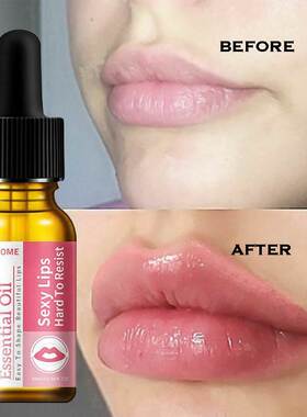 Lip Plumper Nourish Lip Glow Remove Dead Skin Volumising Moi