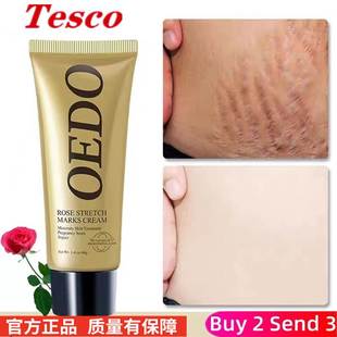 Cream Anti Care Stretch Oil Skin Mark Firming Removes Aging