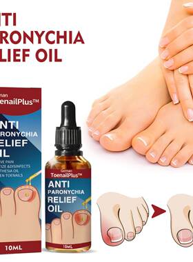 Anti nail groove relief oil for repairing hand and foot nail