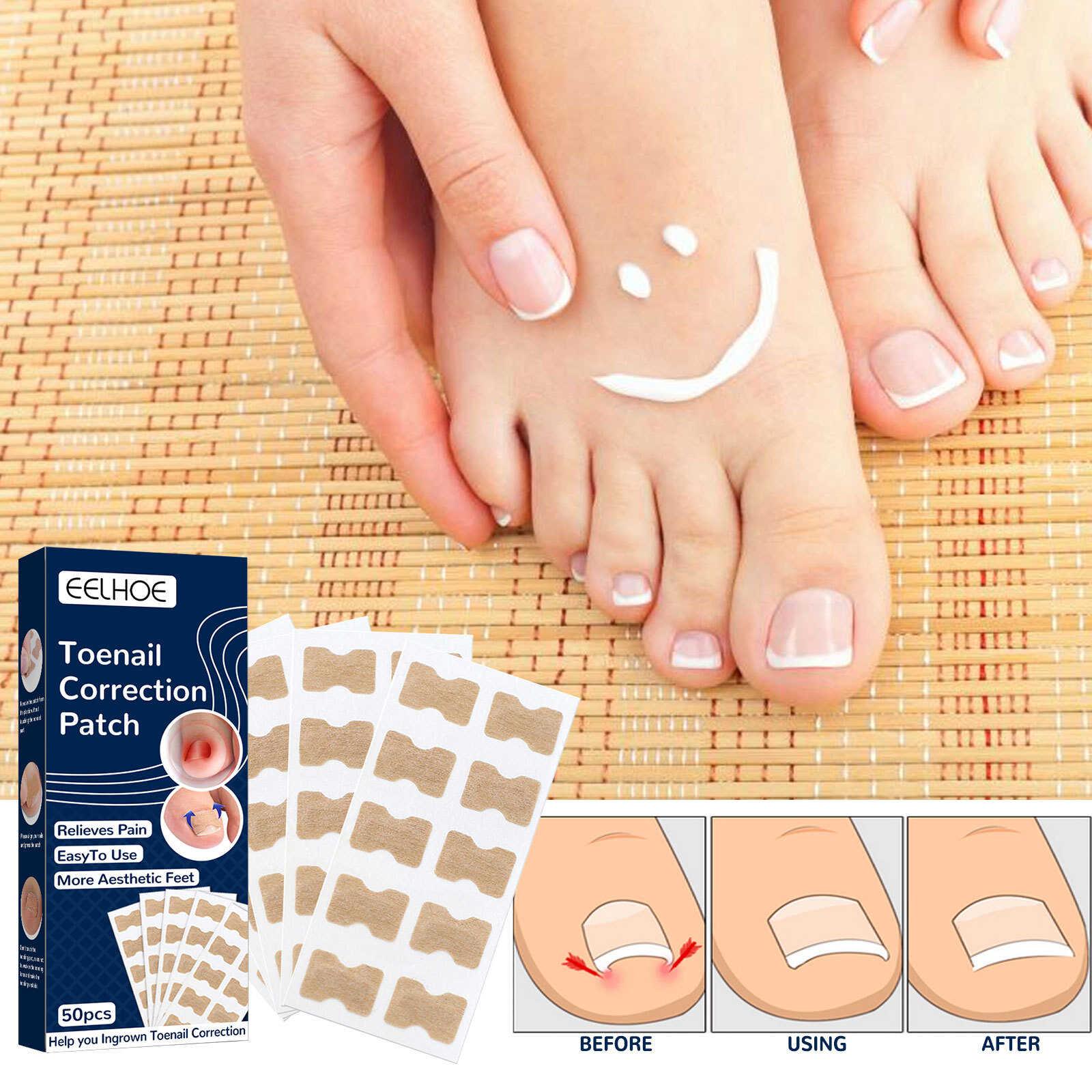 Footnailycorrephsk