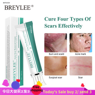 Acne Scar Removal Cream Face Repair Skin Whitening cream30g