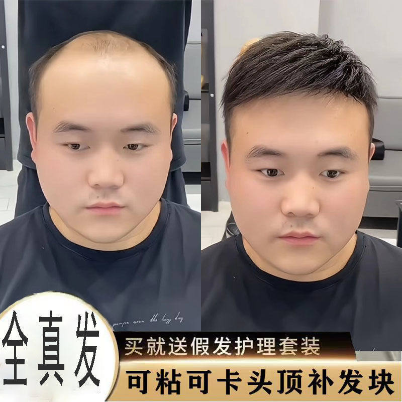 男士假发短发真发帅气隐形头顶补发遮地中海秃头年轻男士补发片