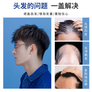 假发男短发全真发隐形无痕韩版帅气碎盖纹理烫轻薄透气头顶补发片