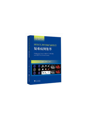 正版 PET/CT,PET/MR与SPECT疑难病例集萃 9787308204897 浙江大学出版社