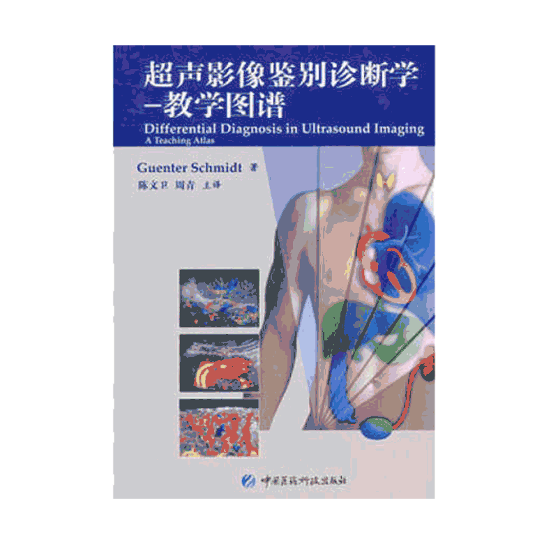 正版图书超声影像鉴别诊断学