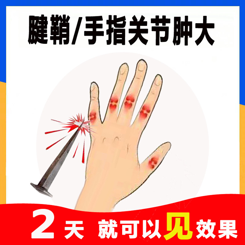 腱鞘贴健鞘炎手指变形肿大手关节骨节痛手腕舒筋拇指膏鼓包喷雾剂