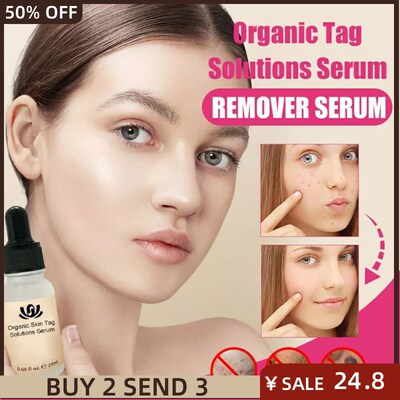 1Pcs Mole And Skin Tag Remover Liquid Genital Wart Treatment